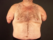 2009_torso